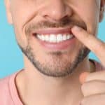 teeth whitening penrith